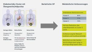 Menschen mit einem hohen Risiko für Typ-2-Diabetes und Folgeerkrankungen profitieren besonders stark von eine bariatrischen OP.  DZD